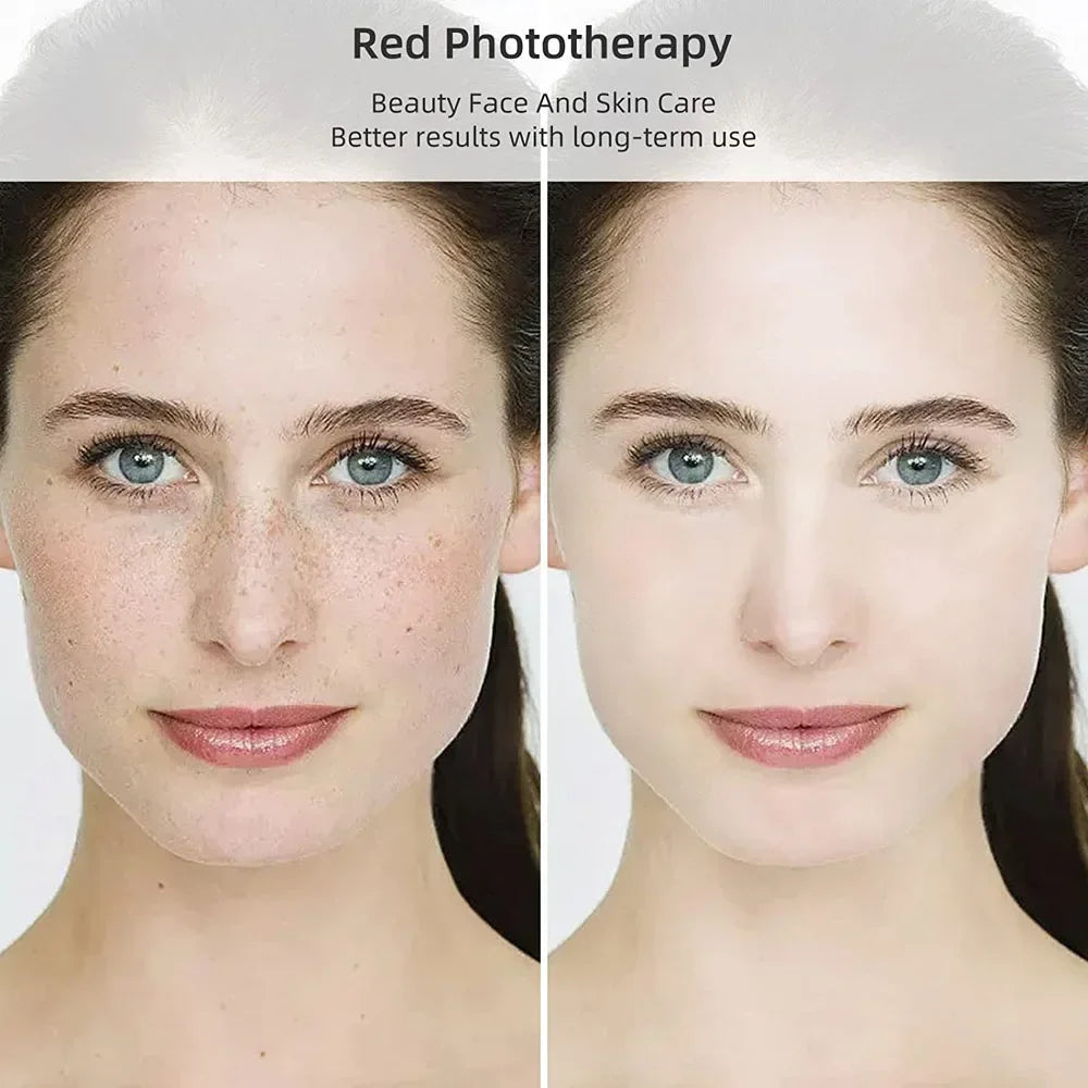 Red phototherapy for face skin care: before and after results showing clearer, smoother skin tone